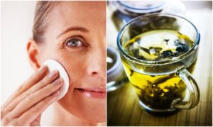 get rid of ance with green tea